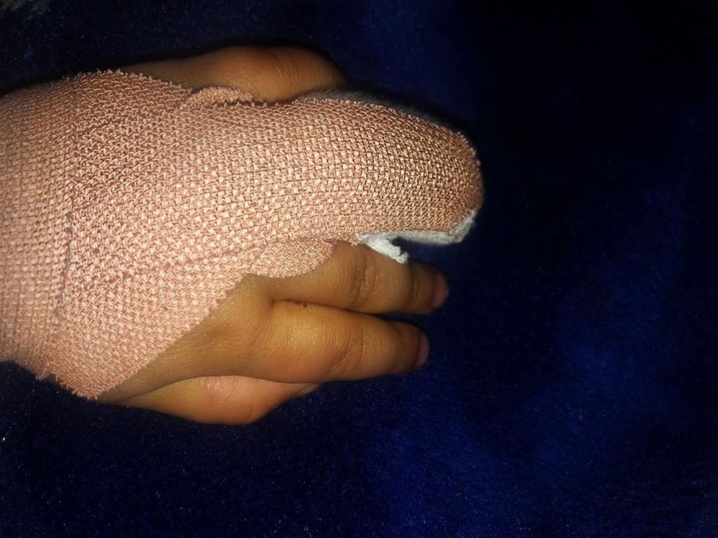 Bandaged Hand