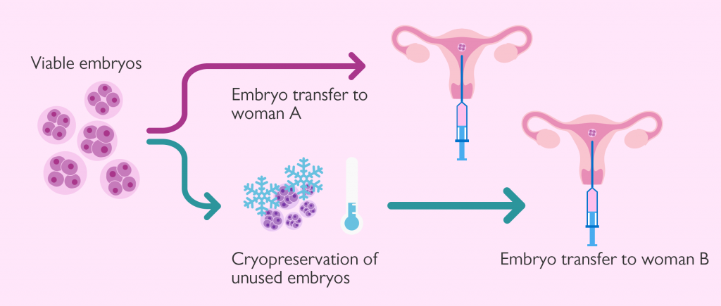 Process Of Embryo Transfer