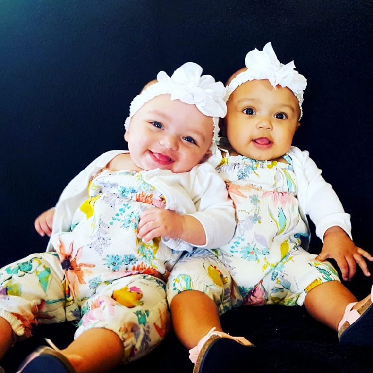 One Black and One White Twins What Do They Look Like 18 Years Later