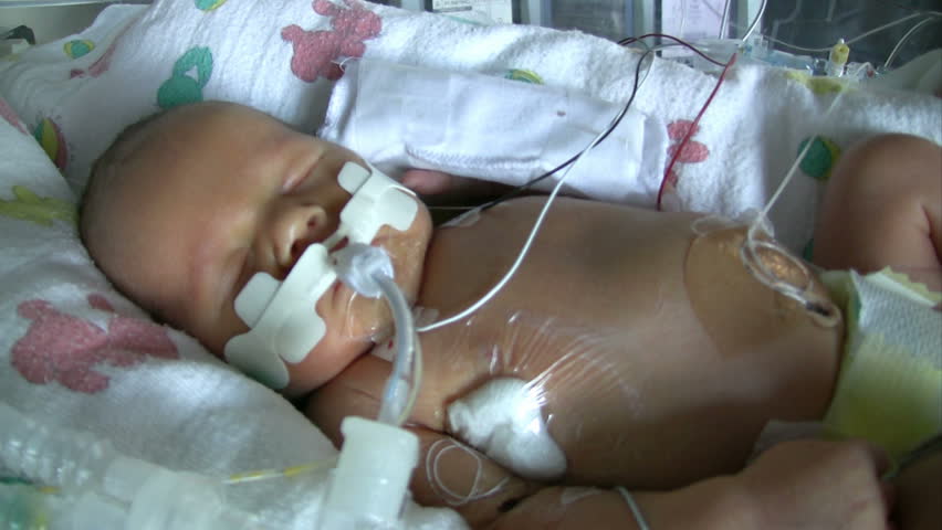 Baby On A Ventilator