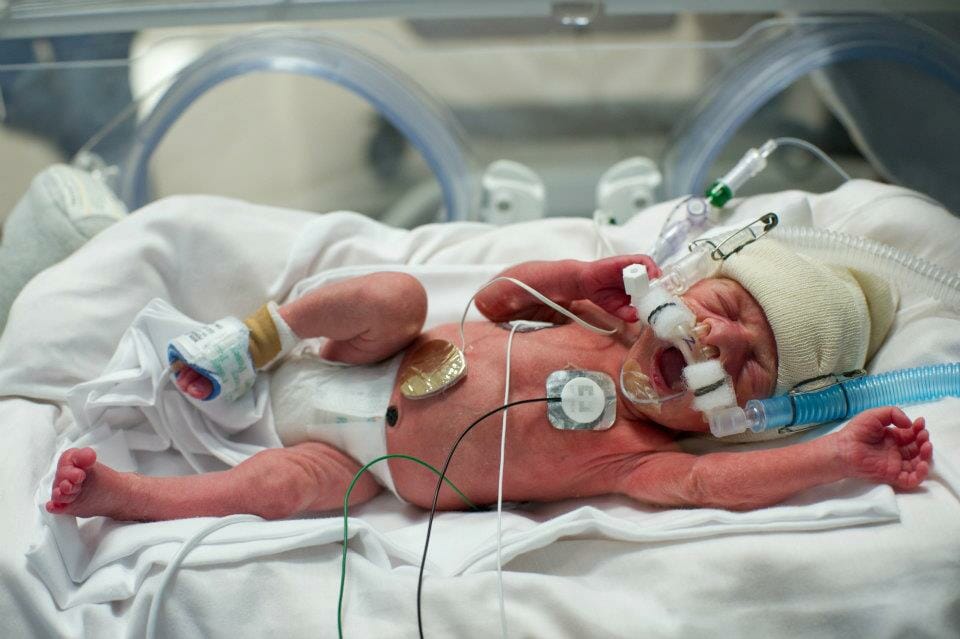 Leah In The NICU