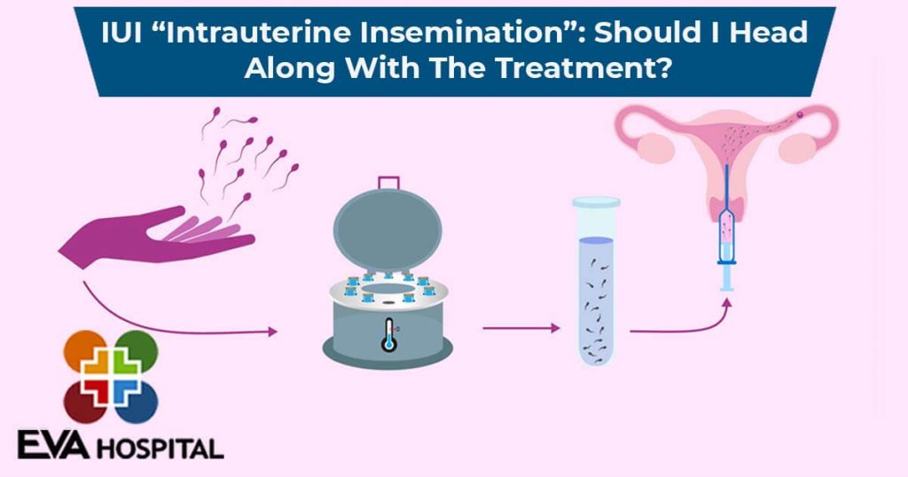 A Diagram Depicting The IUI Process