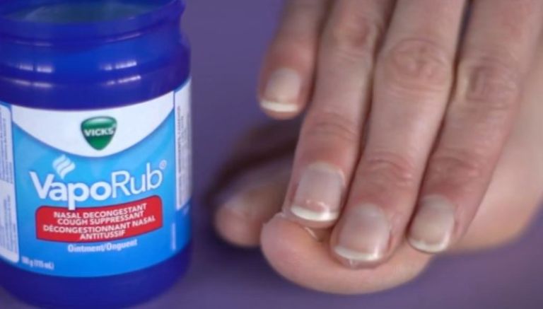 No More Nail Fungus